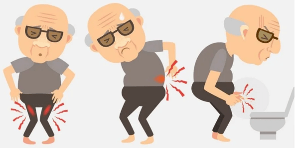 Symptoms of prostatitis