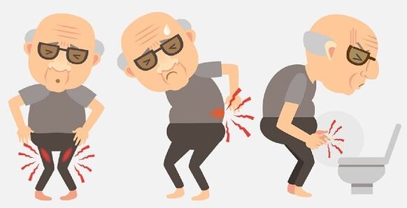 Symptoms of prostatitis and their treatment with medication